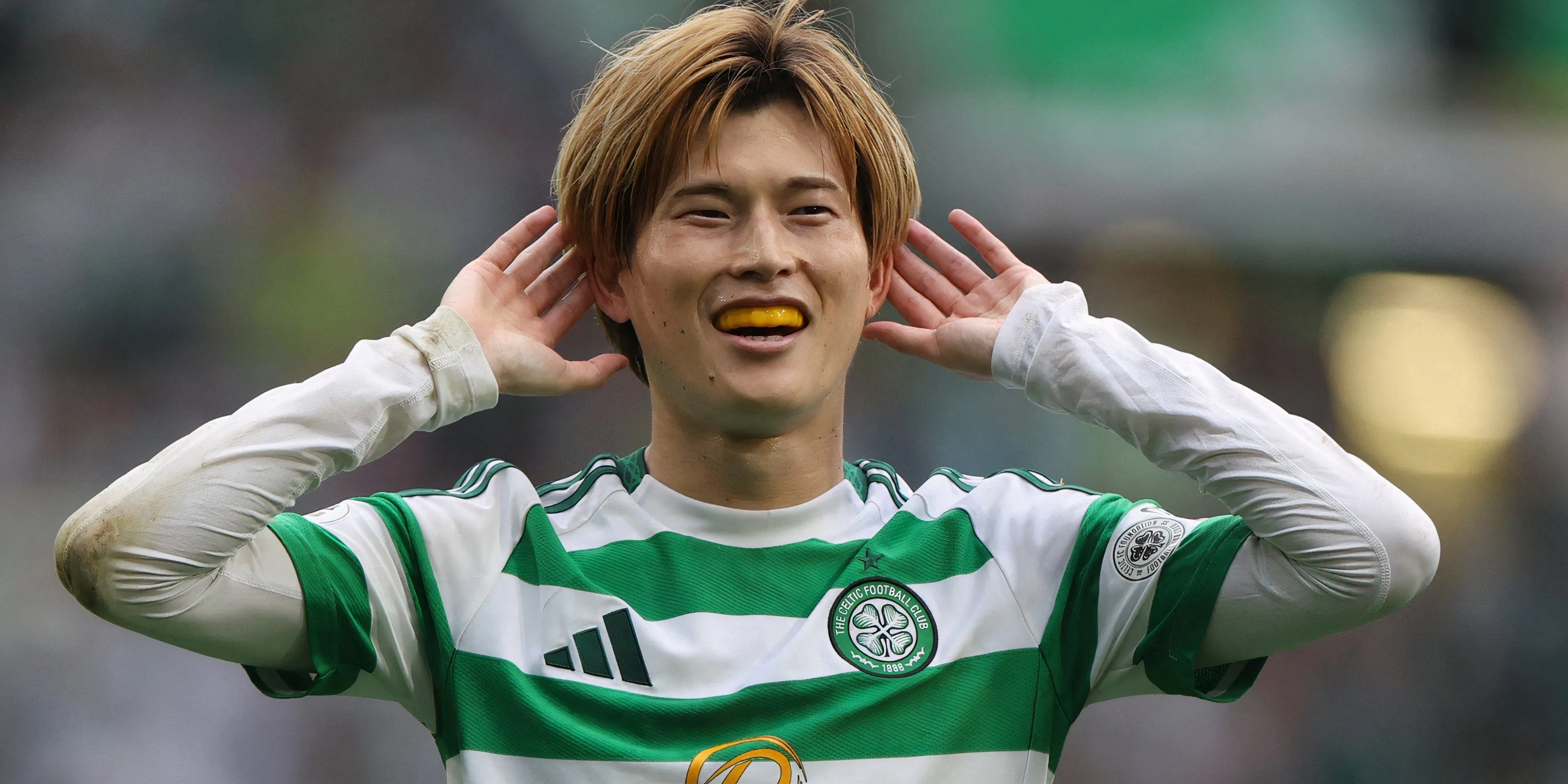 Kyogo Furuhashi thi đấu cho Celtic tại giải Ngoại hạng Scotland, so sánh với Odsonne Edouard